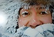 Первая помощь при обморожении