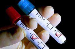ГБУЗ ТО «Областная больница №20» (с.Уват) приглашает пройти тест на ВИЧ